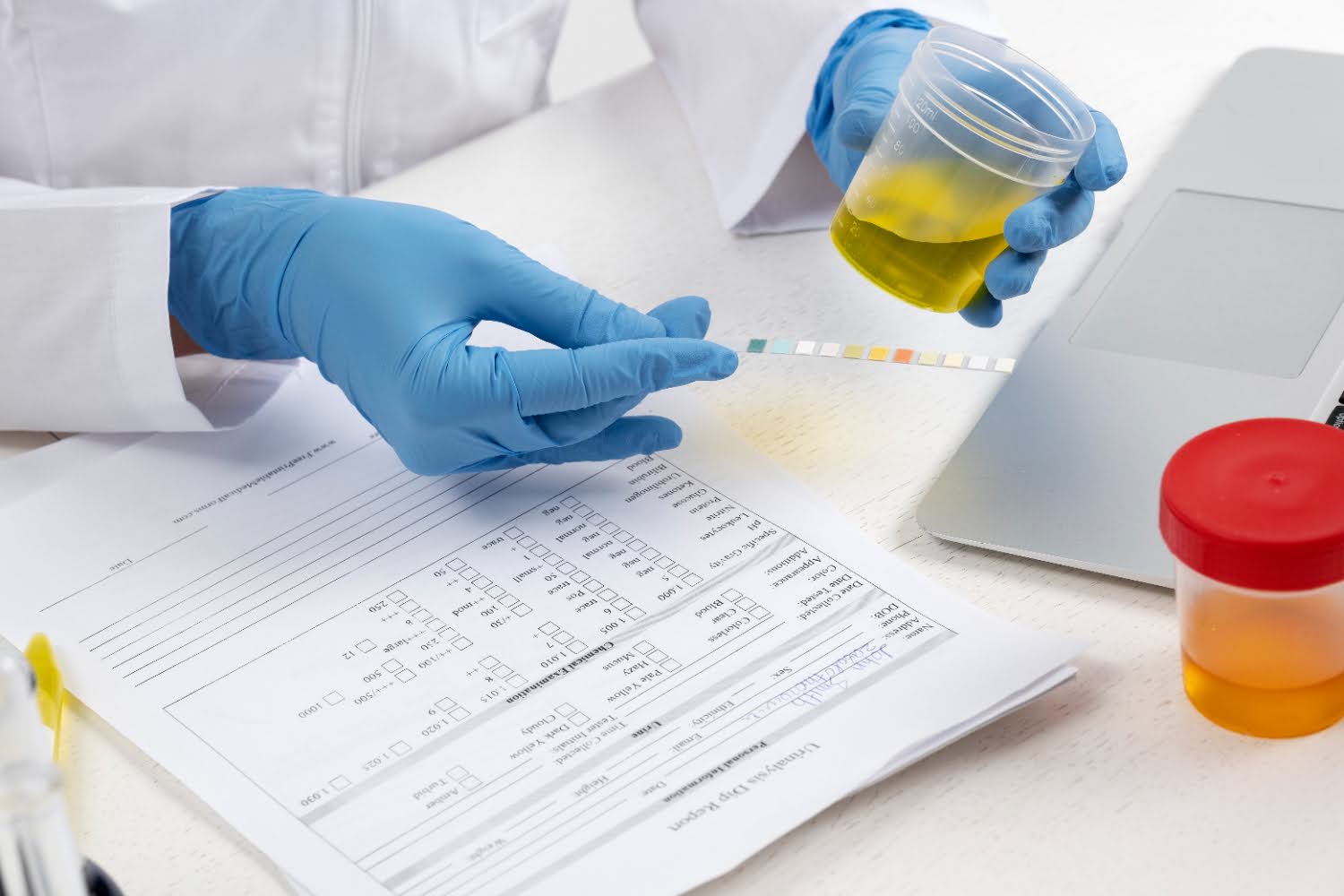 mobmed-drug-testing-sample.jpg